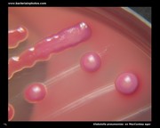 lactose positive colonies
